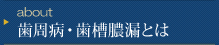 歯周病・歯槽膿漏とは